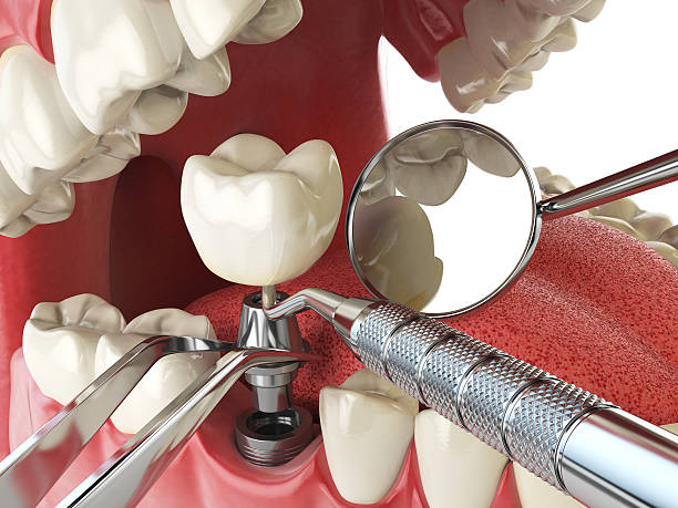 Best Pediatric Emergency Dentist in Laurel Hill, NC